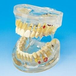 Onemocnění zubů