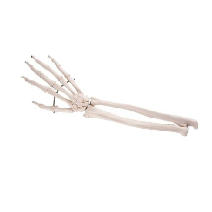 A41 - Kostra ruky s stmi ulnrn a radiln kosti