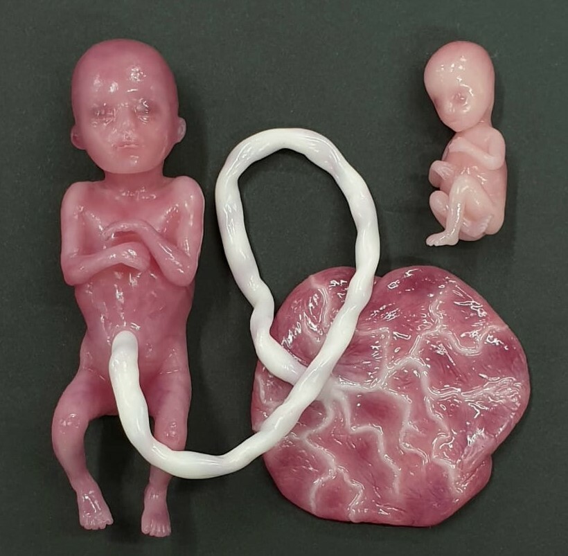 Modely plod z potrat