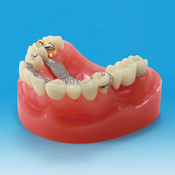 Model restaurace/nhrady zubu PE-PRO002
