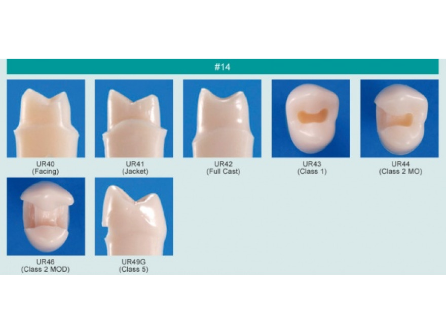 Model zubu s klnovm defektem (zub . 14)