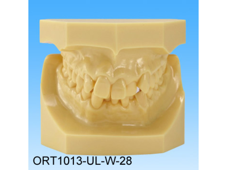 Pryskyin model vadnho skusu (tda II skupina 2 stsnan zuby)