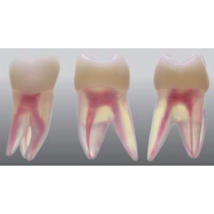 Endodontick model zubu - 3 kanlky