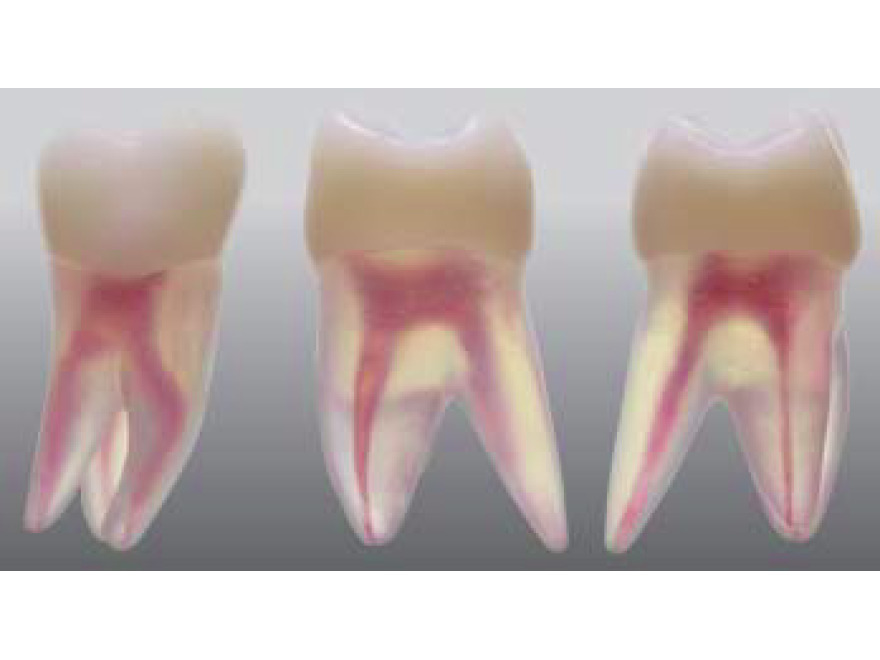Endodontick model zubu - 3 kanlky