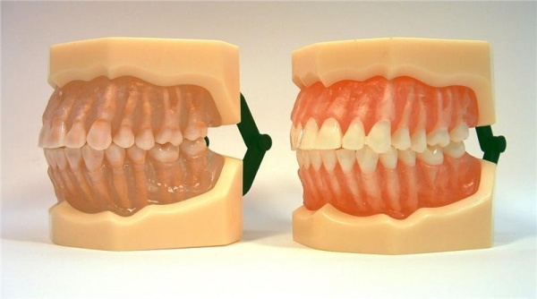 MDO-07 - Vyjmateln anatomick zuby