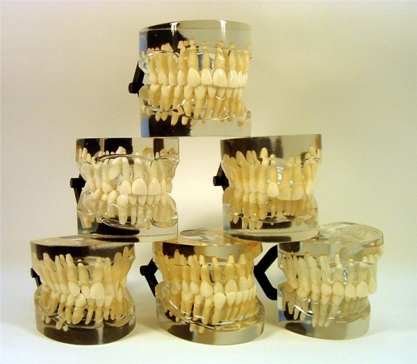 MDO-18 - Ortodontick modely