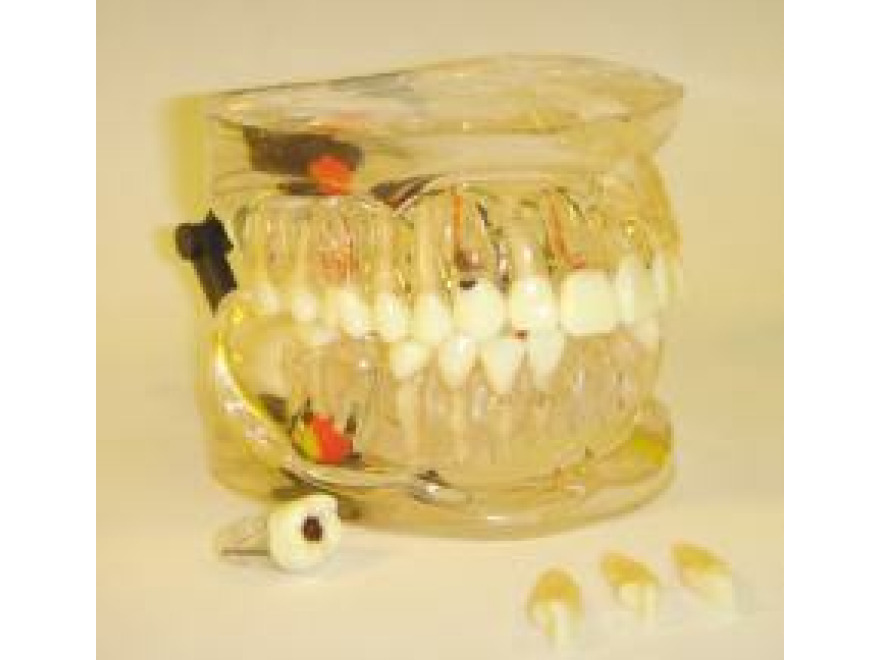MDO-42 - Model s vyjmatelnmi zuby
