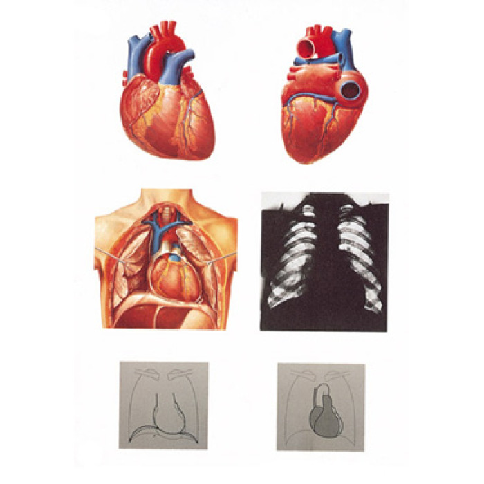 V2053U - Lidsk srdce