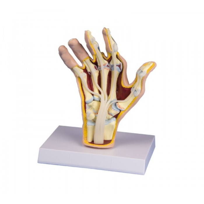 M26 - Model ruky s revmatoidn artritidou